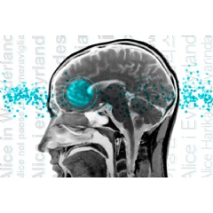 In a brain-imaging study, neuroscientists found similar patterns of brain activation across language areas such as Brocas area.
Credits:
Image: Christine Daniloff, MIT; iStock image