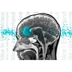In a brain-imaging study, neuroscientists found similar patterns of brain activation across language areas such as Broca’s area.
Credits:
Image: Christine Daniloff, MIT; iStock image