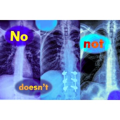 MIT researchers found that vision-language models, which are widely used to analyze medical images to streamline diagnosis, do not understand negation words like “no” and “not.”
Credits:
Image: iStock; MIT News