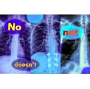 Study shows vision-language models cant handle queries with negation words