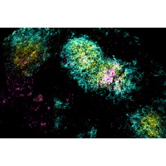 Image shows the vaccine antigen (pink) being concentrated in a germinal center (yellow) within B cell follicles (cyan), triggered by the researchers’ combination adjuvant vaccine.
Credits:
Image: Courtesy of the researchers
