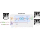 PRISM: An Explainable Generative AI Model for Medical Imaging