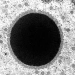 This microscopic image shows a sun-shaped area within turtle skin cells where chelonid herpesvirus 5 replicates. The virus capsids, or protein shells, are arrayed like a corona around the circle. (Credit: Thierry Work, USGS)
