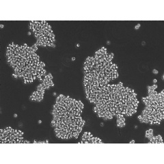 High power view of human AT/RT cancer cells growing in a dish.
Credit: Eric Raabe
