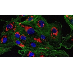 A microscopic image of endothelial cells treated with drug-loaded nanoparticles. (Image courtesy of the Saltzman Lab)
