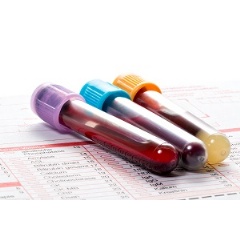 The first peer-reviewed implementation guide for the High Value Practice Academic Alliance recommends eliminating a blood test that adds no values in evaluating patients with suspected heart attacks. Credit: iStock